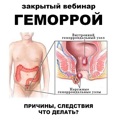 [pravda.pro.pisheprom] Женя Братишка, Юля Братишка ― Геморрой (2024)